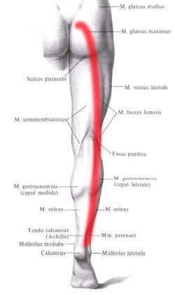 Przepuklina kręgosłupa objawy ból nogi
