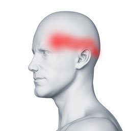 Szyjnopochodny ból głowy