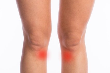 Gęsia stopka – mapa bólu kolana