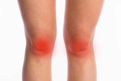 Zwyrodnienie kolana - mapa bólu