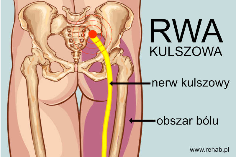 Korzonki nerwowe leczenie domowe