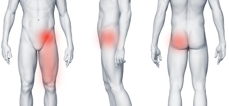 Staw biodrowy – ból przy przewracaniu z boku na bok