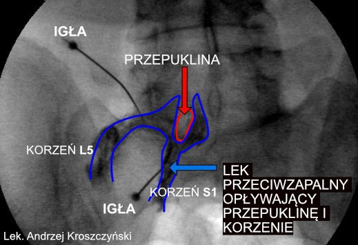 Jak zamienić paka od zwierzaka sterydy w sukces?