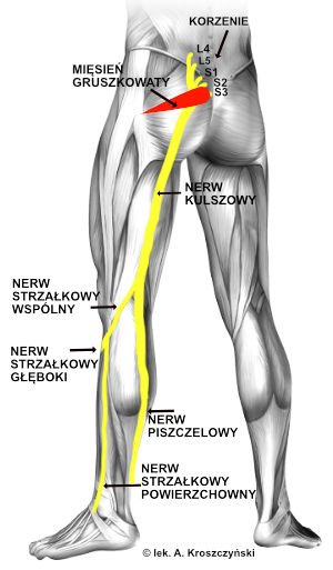 Schemat nerwu kulszowego – przebieg nerwu