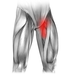 Ból w lewej pachwinie promieniujący na nogę - mięśnie