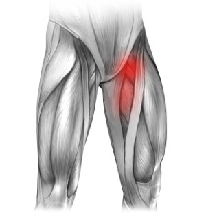 Przepuklina i ból w lewej pachwinie promieniujący na nogę