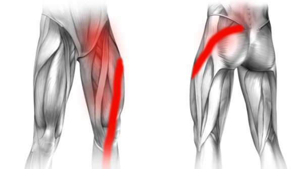 Rwa kulszowa i ból w lewej pachwinie promieniujący na nogę