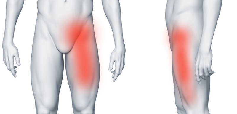 Ból w lewej pachwinie promieniujący na nogę