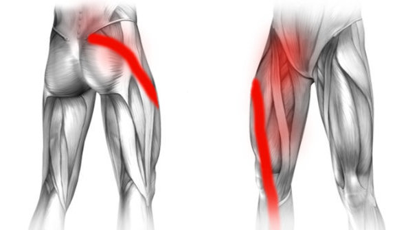 Rwa kulszowa i ból w prawej pachwinie promieniujący na nogę
