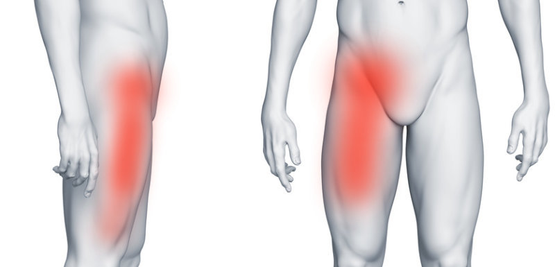 Ból w prawej pachwinie promieniujący na nogę