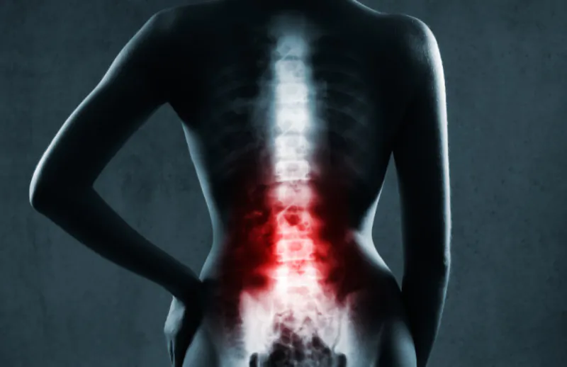 Ból kręgosłupa lędźwiowego – co pomaga, ból w nocy i przy schylaniu